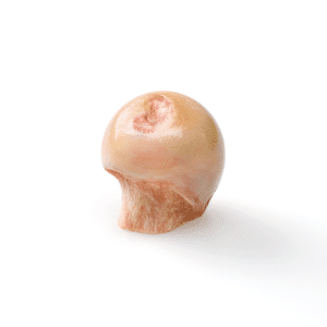 Femoral Head Whole, Irradiated, Frozen