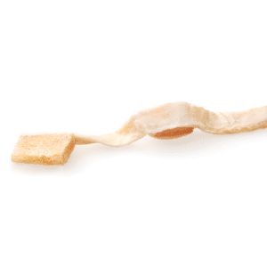 Tendon hémi rotulien avec extenseur, irradié