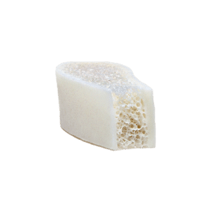 Cale de crête iliaque tricorticale, lyophilisée, H: 10mm